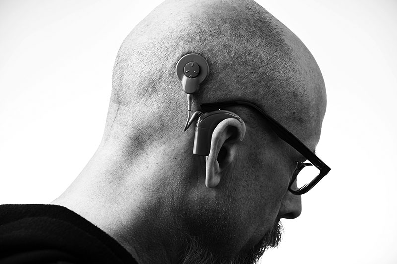 A photo of a man wearing a cochlear implant